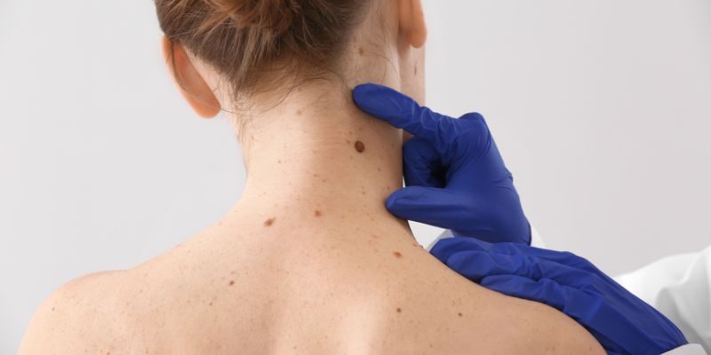 Bí Ẩn Nốt Ruồi Phong Thủy Và Vận Mệnh Chưa Có Lời Giải! 2 Bật mí ý nghĩa đằng sau những tiền tài đại gia